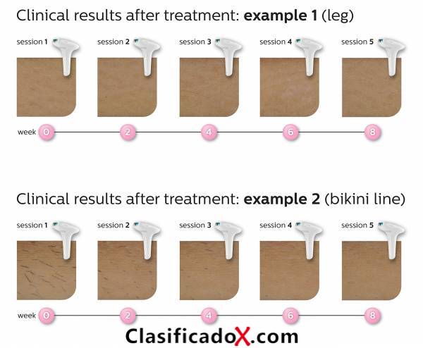 ClasificadoX - Anuncios clasificados relax y contenido erótico