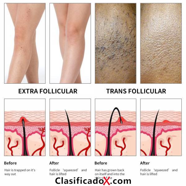 ClasificadoX - Anuncios clasificados relax y contenido erótico