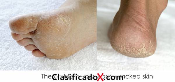 ClasificadoX - Anuncios clasificados relax y contenido erótico