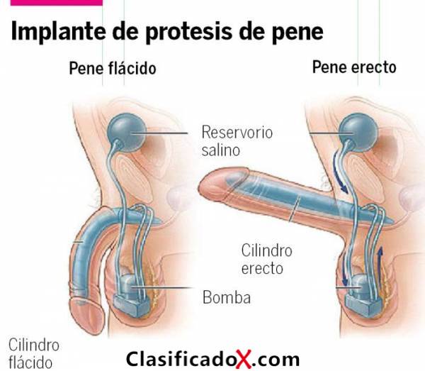 ClasificadoX - Anuncios clasificados relax y contenido erótico