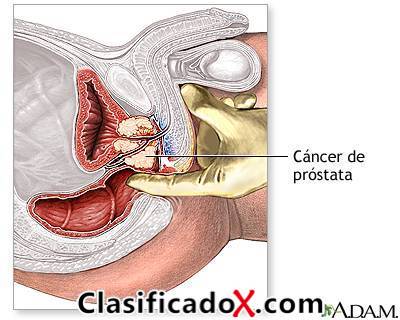 MASAJE  PROSTATICO  ARA CABALLEROS CUENTO CON LUGAR   EVITA SER PRECOZ