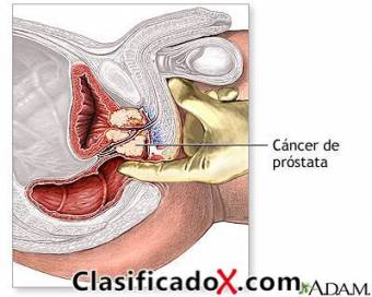 MASAJE  PROSTATICO  ARA CABALLEROS CUENTO CON LUGAR   EVITA SER PRECOZ