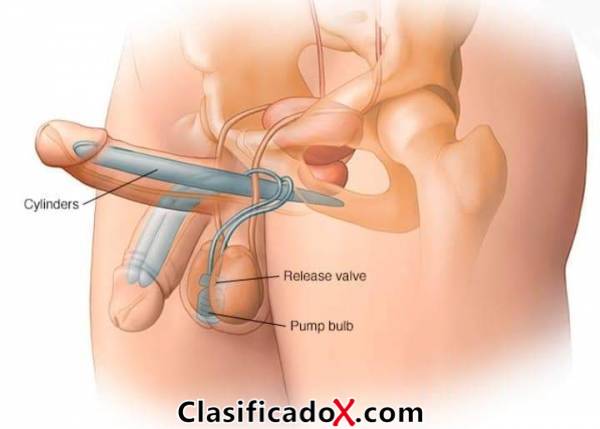 ClasificadoX - Anuncios clasificados relax y contenido erótico
