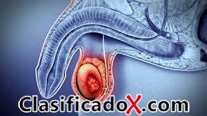 ClasificadoX - Anuncios clasificados relax y contenido erótico