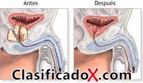 ClasificadoX - Anuncios clasificados relax y contenido erótico