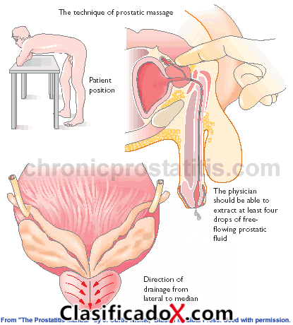 ClasificadoX - Anuncios clasificados relax y contenido erótico