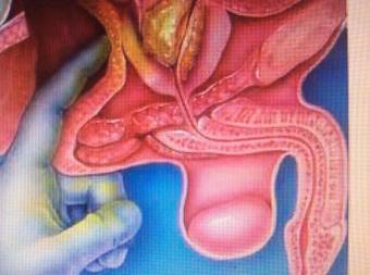 verdadero masaje  prostatico con lugar  domingo  en promocion