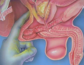 masaje  prostatico  1500   no te vengas  rapido  dura  mas   se dobla  aumenta  tu  dureza