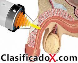 ClasificadoX - Anuncios clasificados relax y contenido erótico