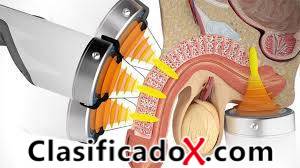 ClasificadoX - Anuncios clasificados relax y contenido erótico