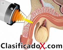 MASAJE  PROSTATICO   RESULTADOS  INMEDIATOS  EVITA FLASIDES Y RAPIDES