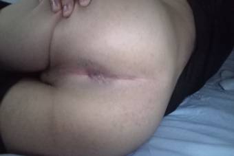 Virgen pasivo colágeno -17 inexperto